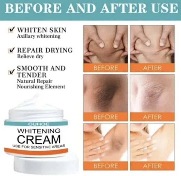 Sensitive Area Whitening Cream | Lightening for Private Parts, Underarms & Inner Thighs (30ml)